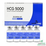 AkraLabs HCG 5000 (25.000 IU Kit)